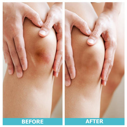 LIFARA Hydrocolloid Roll for Wound Care - Cut-To-Size, Extra Large Hydrocolloid Patch Bandages with Self-Adhesive, Ultra Absorbent, Flexible & Waterproof, First Aid Kit Essential (2In*16Ft, 11.8Mil/ 0.3Mm Thickness)) Healthcare Acne Pimple Patch Bandaids