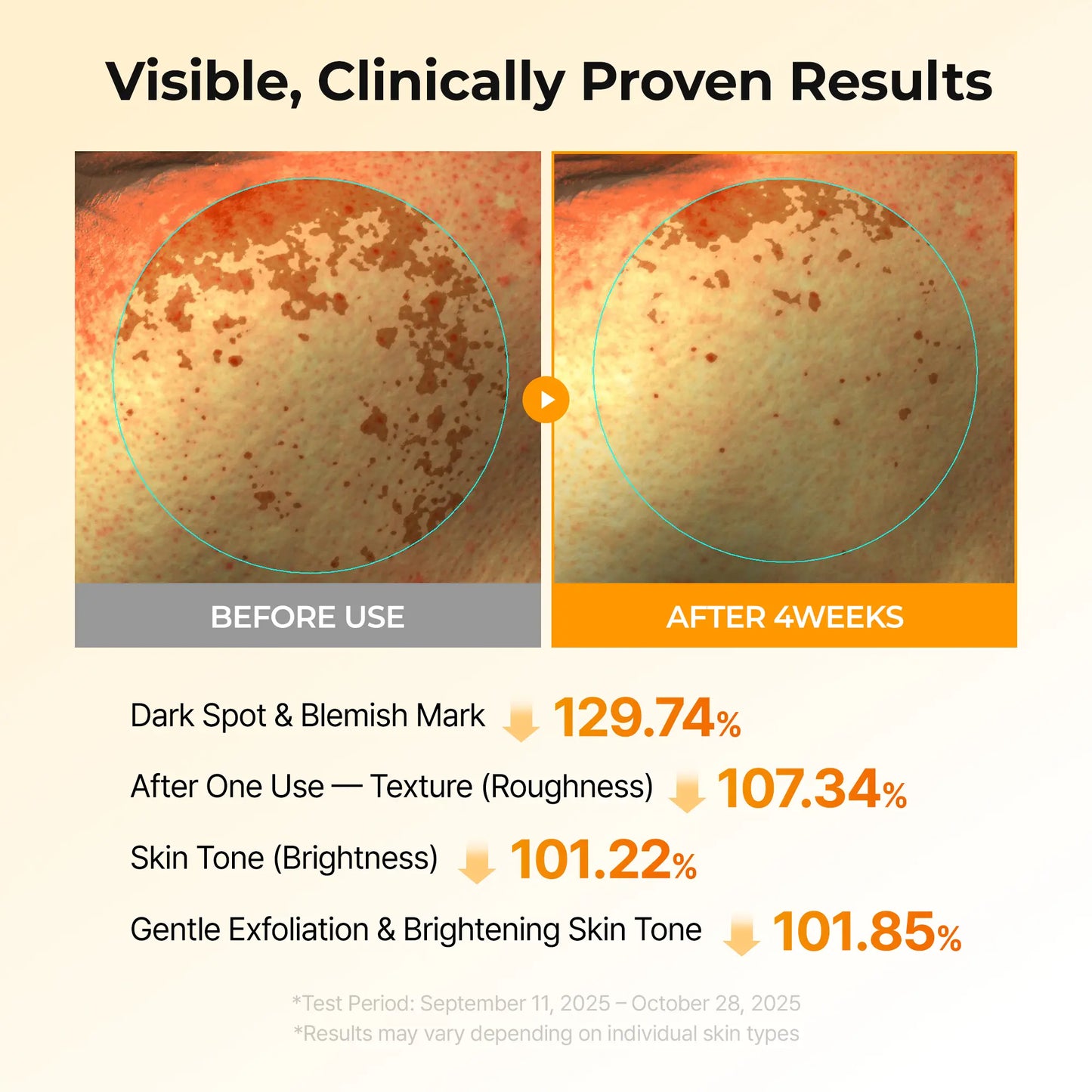 [Dr.Melaxin Official] Kojic Acid Turmeric TX Toner Pad 70Pads, Dark Spot & Pigmentation Care for Uneven Skin Tone
